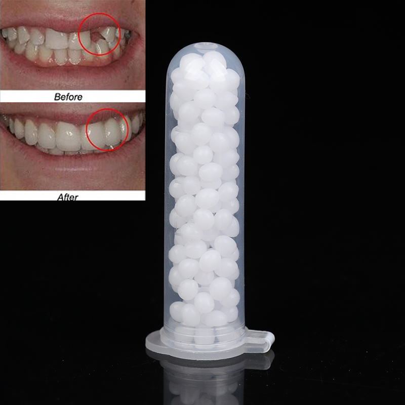 【K】1Box Temporary Tooth Repair - огляд і ціна Teeth Whitening Kit