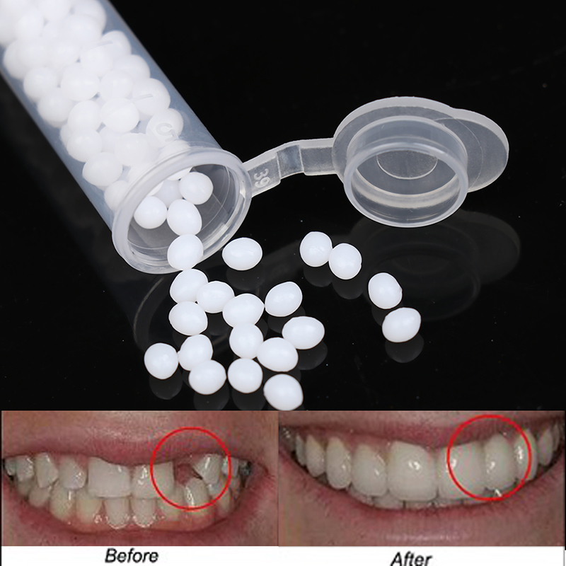 【K】1Box Temporary Tooth Repair - огляд і ціна Teeth Whitening Kit